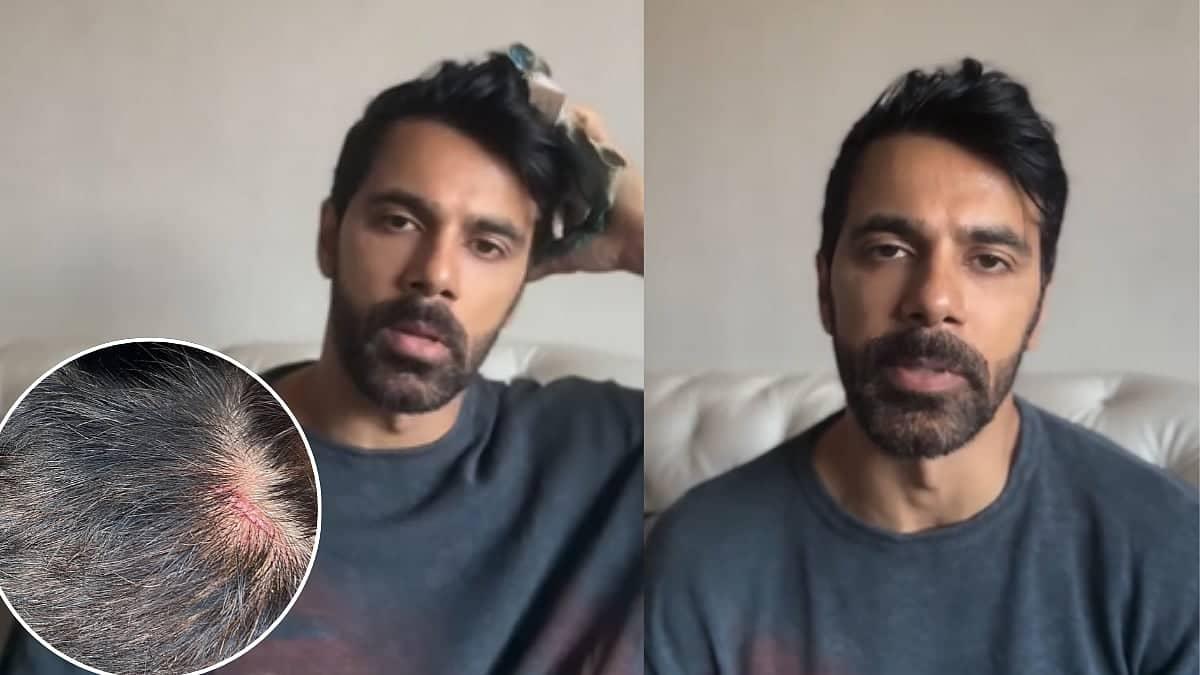 Anuj Sachdeva's Assault: Mumbai Police, What Are You Doing?