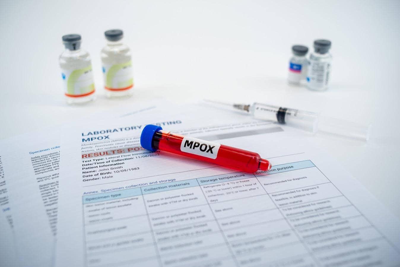 Kerala's Mpox Outbreak: UAE Travel Fuels Viral Adventure