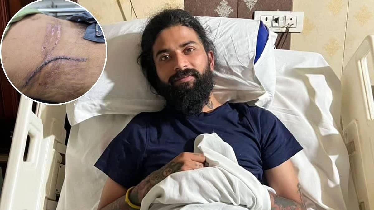 UK07 Rider Anurag Dobhal Shows Off Injury Scars, Asks Fans