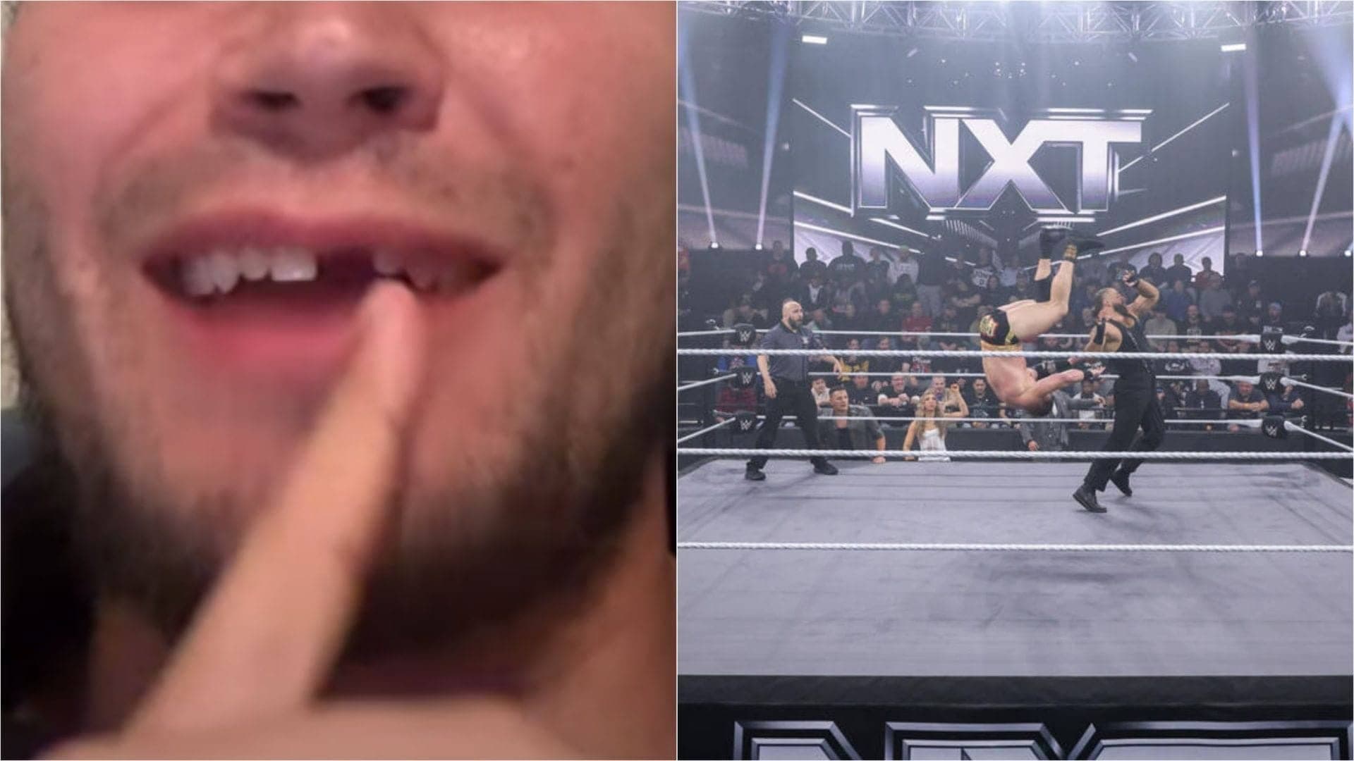 WWE star Shiloh Hill ka denture ud gaya, kya comedy hai bhai!