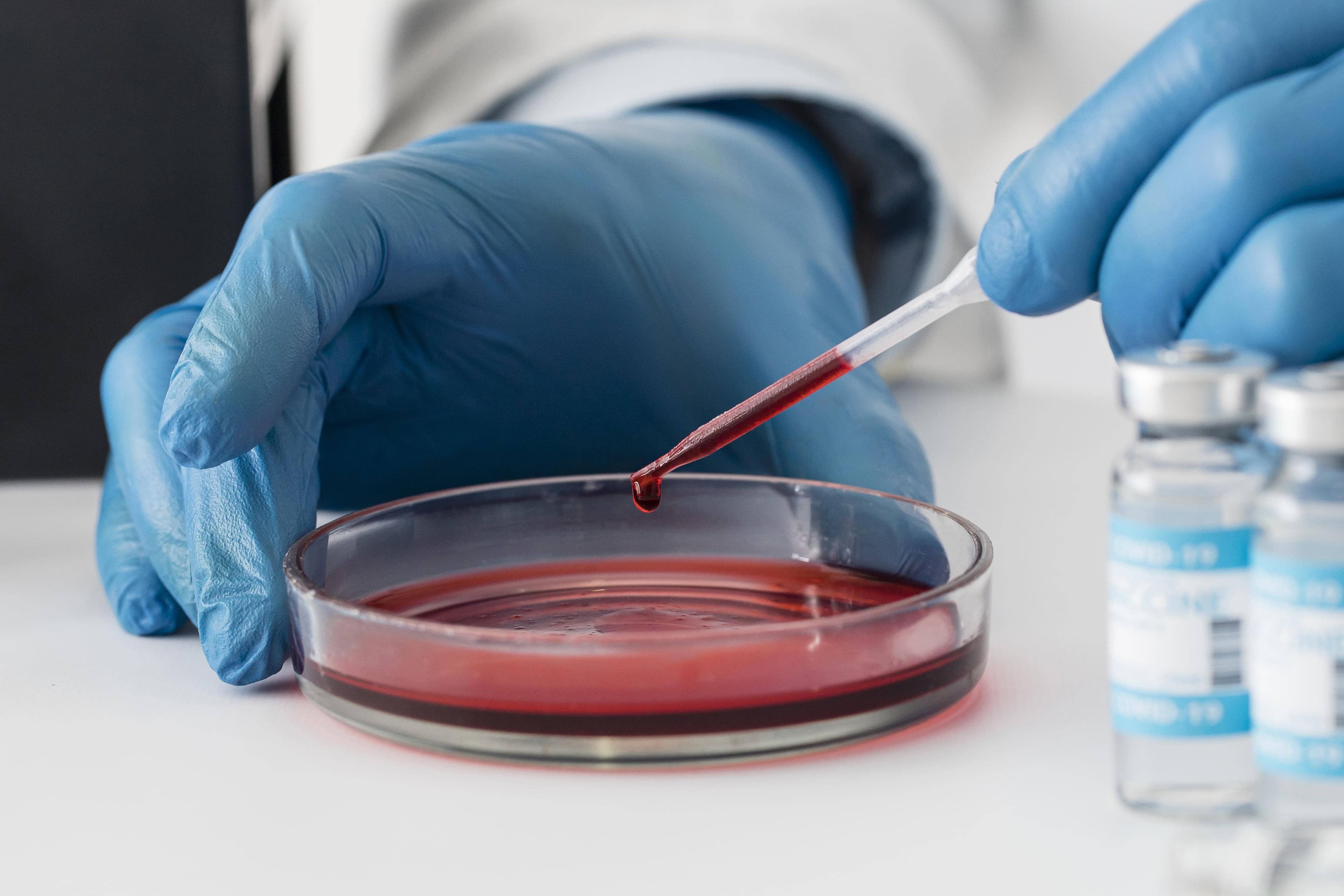 World Haemophilia Day 2026: Pehle jaan, phir care ka safar!
