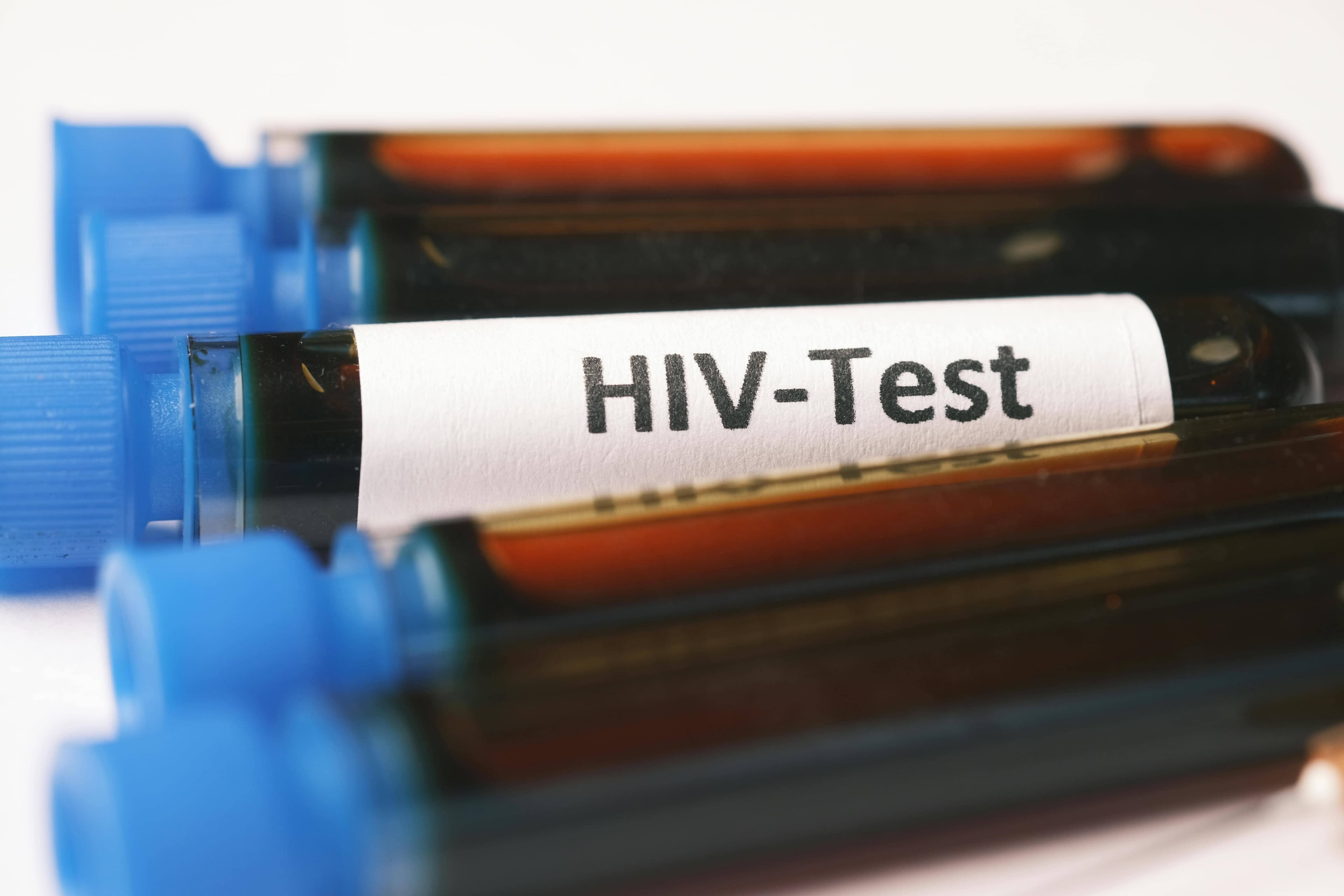 Toronto Legend Beats HIV After Wild Bone Marrow Journey