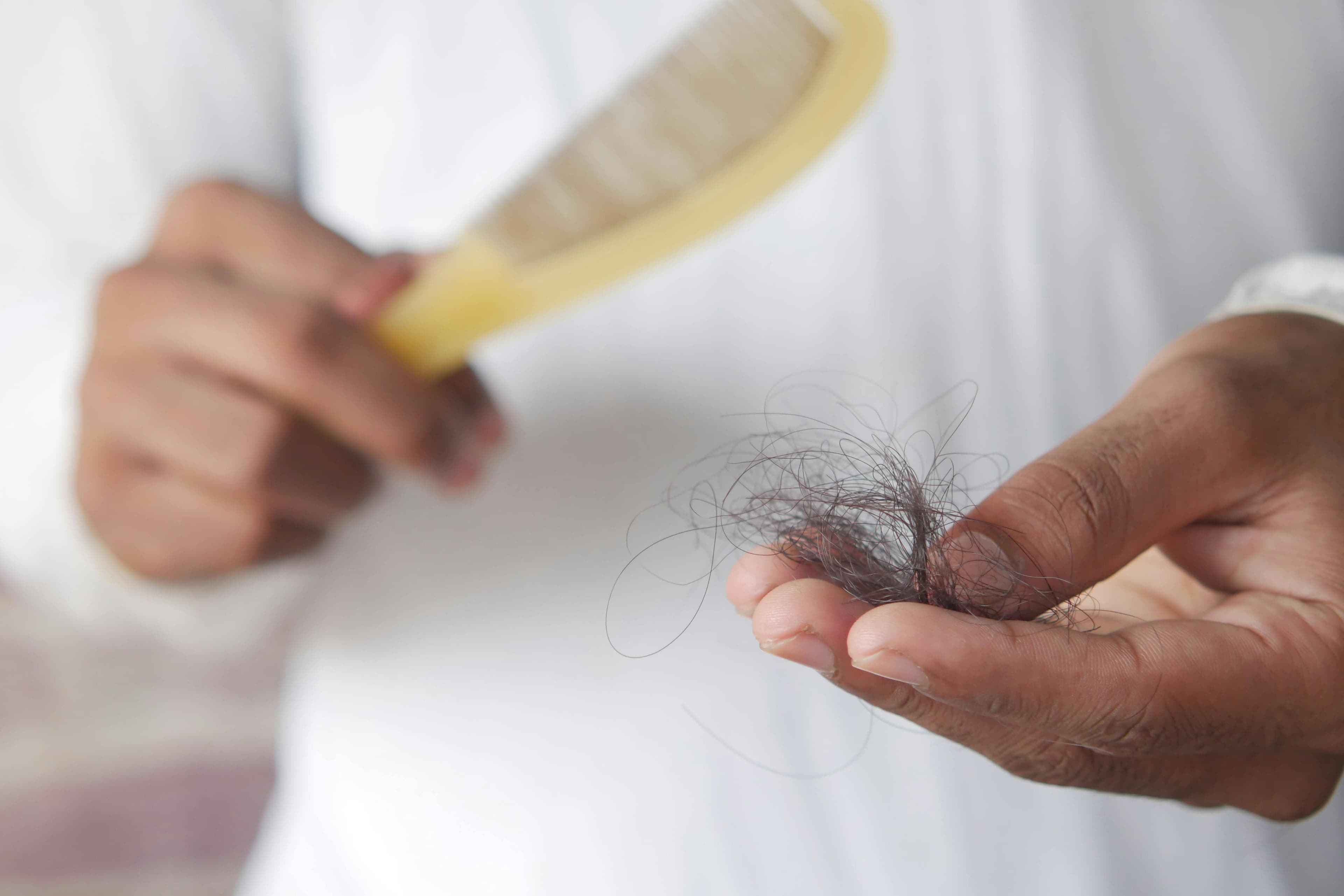 Is hair loss reversible? New study shifts focus to the scalp ecosystem