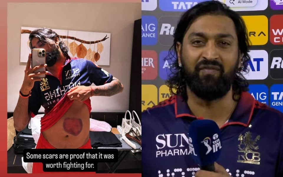 Krunal Pandya shows off his battle scar after match-winning knock in RCB vs MI