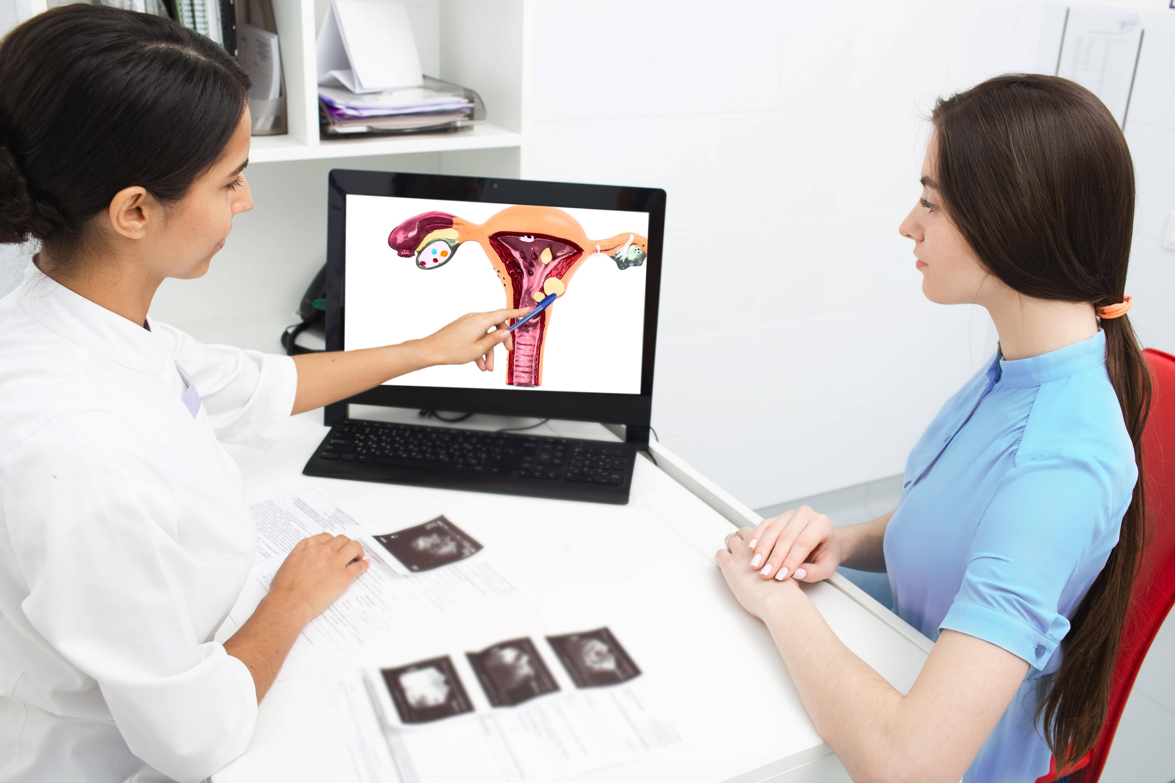 PCOS Gets a Fun Makeover: Welcome PMOS for Better Care!