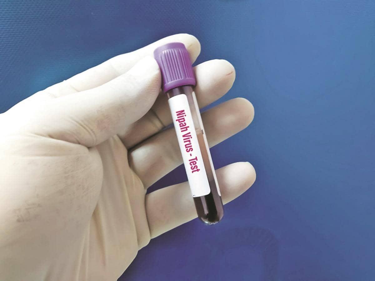 WHO Declares Low Nipah Virus Risk, No Travel Bans Needed!