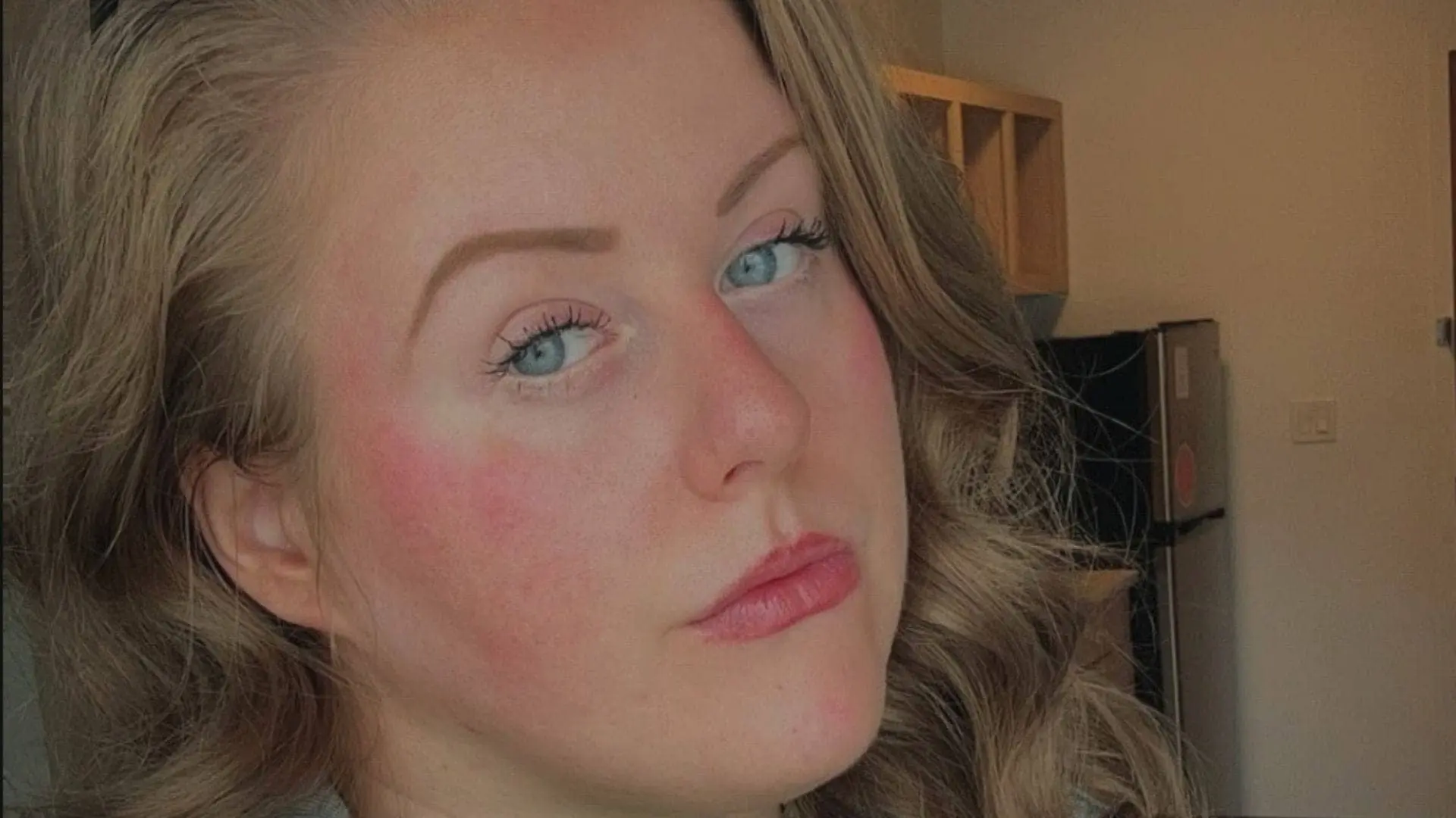 Piper Niven's Surgery Journey: A Strong Comeback Ahead